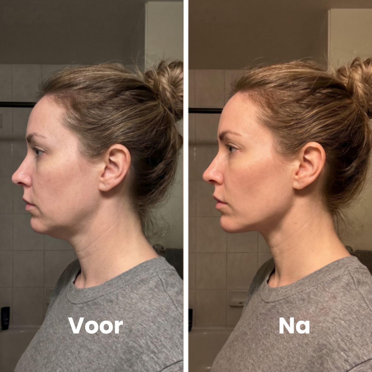Lymera Gezichtsborstel voor Lymfedrainage
