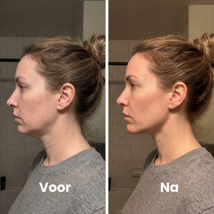 Lymera Gezichtsborstel voor Lymfedrainage